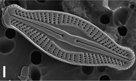 Microcostatus naumannii (Husted) Lange-Bertalot