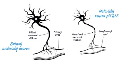 2026_01_12_ALS_box 2026_01_12_ALS_box